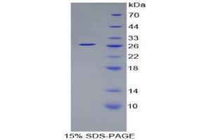SDS-PAGE (SDS) image for Spondin 2 (SPON2) (AA 119-330) protein (His tag) (ABIN1879760)