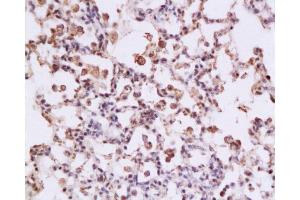 Formalin-fixed and paraffin embedded rat lung tissue labeled with Anti-STAT3 Polyclonal Antibody, Unconjugated at 1:200 followed by conjugation to the secondary antibody , (SP-0023), and DAB staining