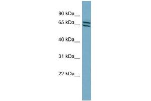 WB Suggested Anti-PDE1C Antibody Titration: 0. (PDE1C anticorps  (Middle Region))