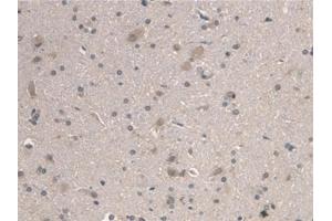 Detection of ARNTL in Rat Cerebrum Tissue using Polyclonal Antibody to Aryl Hydrocarbon Receptor Nuclear Translocator Like Protein (ARNTL)