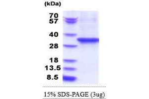 SDS-PAGE (SDS) image for Eukaryotic Translation Elongation Factor 2 (EEF2) (AA 574-858) protein (His tag) (ABIN5853814) (EEF2 Protein (AA 574-858) (His tag))