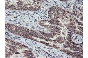 Image no. 2 for anti-Tryptophan 2,3-Dioxygenase (TDO2) antibody (ABIN1501352)