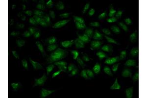 Immunofluorescence analysis of HeLa cell using YWHAB antibody. (YWHAB anticorps)