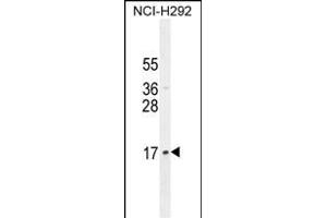 LLPH Antibody (Center) (ABIN654797 and ABIN2844474) western blot analysis in NCI- cell line lysates (35 μg/lane). (LLPH anticorps  (AA 62-90))