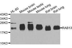 Western blot analysis of extracts of various cell lines, using RAB31 antibody. (RAB31 anticorps)