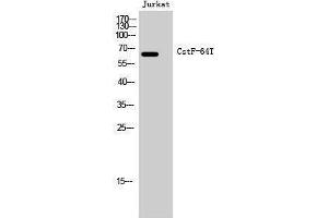 Western Blotting (WB) image for anti-CstF-64T (Internal Region) antibody (ABIN3180563) (CstF-64T (Internal Region) anticorps)