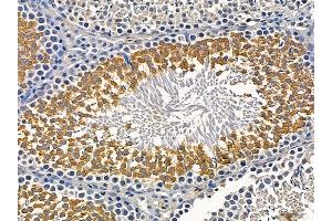 ABIN7095528 and ABIN7099585 at 1/100 staining rat testis tissue by IHC-P.