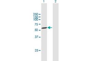 Western Blot analysis of PICK1 expression in transfected 293T cell line by PICK1 MaxPab polyclonal antibody.