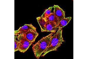 Immunofluorescence analysis of Hela cells using MSH6 mouse mAb (green). (MSH6 anticorps  (AA 374-540))