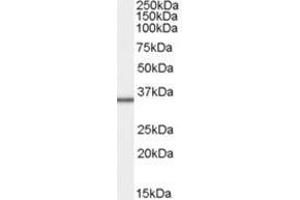Image no. 1 for anti-Mitochondrial Ribosomal Protein L3 (MRPL3) (C-Term) antibody (ABIN374279) (MRPL3 anticorps  (C-Term))