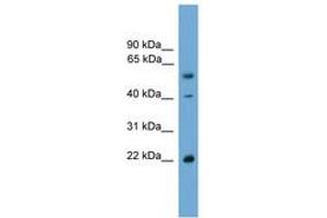 Image no. 1 for anti-WW Domain Binding Protein 4 (WBP4) (AA 35-84) antibody (ABIN6744958) (WBP4 anticorps  (AA 35-84))