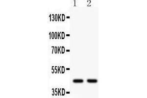Observed bind size: 45KD