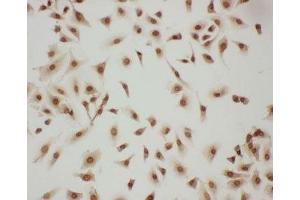 ICC testing of LASP1 antibody and A549 cells