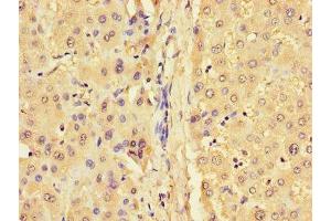 Immunohistochemistry of paraffin-embedded human liver tissue using ABIN7153605 at dilution of 1:100 (GJB1 anticorps  (AA 215-283))