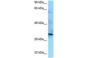 Image no. 1 for anti-Protein Phosphatase 6, Catalytic Subunit (PPP6C) (AA 90-139) antibody (ABIN6748166) (PPP6C anticorps  (AA 90-139))