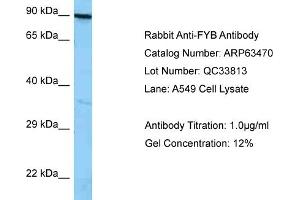 Western Blotting (WB) image for anti-FYN-Binding Protein (FYB) (C-Term) antibody (ABIN2789512) (FYB anticorps  (C-Term))