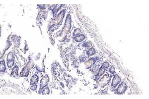 Detection of RSPO1 in Rat Colon Tissue using Polyclonal Antibody to R-Spondin 1 (RSPO1)