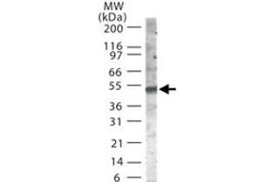 Western blot analysis of SMAD6 in 30 ug of Jurkat cell lysate using SMAD6 polyclonal antibody  at 2 ug/mL . (SMAD6 anticorps  (AA 85-99))