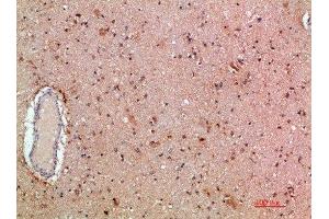 Immunohistochemical analysis of paraffin-embedded human-brain, antibody was diluted at 1:200 (MLL/KMT2A anticorps  (AA 3850-3900))