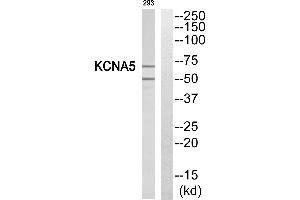 Western blot analysis of extracts from 293 cells, using KCNA5 antibody. (KCNA5 anticorps  (Internal Region))