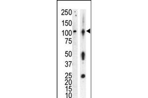 Western blot analysis of anti-PKCnu Pab in lysate of HL60 cells stimulated with PMA (lane A) and mouse brain tissue lysate (lane B) (PRKD3 anticorps  (AA 352-384))