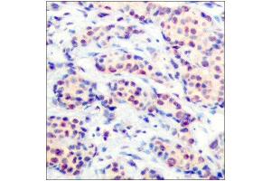 Immunohistochemistry (IHC) image for anti-Jun D Proto-Oncogene (JUND) (Ser255) antibody (ABIN1848124)