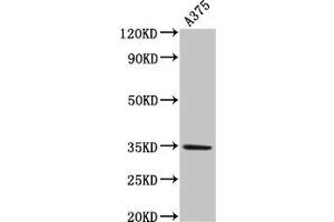 Western Blot Positive WB detected in: A375 whole cell lysate All lanes: MC1R antibody at 4 μg/mL Secondary Goat polyclonal to rabbit IgG at 1/50000 dilution Predicted band size: 35 kDa Observed band size: 35 kDa (MC1 Receptor anticorps  (AA 1-37))