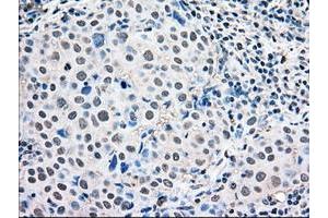 Image no. 2 for anti-Mitogen-Activated Protein Kinase 1 (MAPK1) antibody (ABIN1499287)