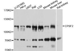 Western blot analysis of extracts of various cells, using CPSF2 antibody. (CPSF2 anticorps)