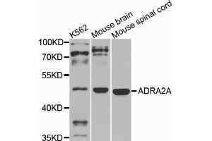 Western blot analysis of extracts of various cell lines, using ADRA2A antibody. (ADRA2A anticorps)