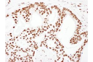 Immunohistochemistry (IHC) image for anti-Tripartite Motif Containing 28 (TRIM28) (AA 1-50) antibody (ABIN7453437) (KAP1 anticorps  (AA 1-50))