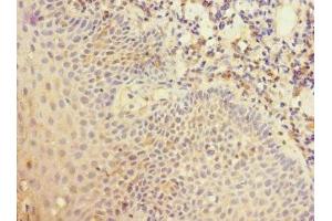 Immunohistochemistry of paraffin-embedded human tonsil tissue using ABIN7148407 at dilution of 1:100 (CD35 anticorps  (AA 420-550))