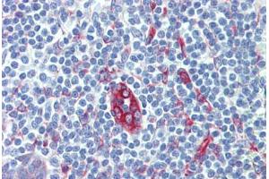 Human Tonsil (formalin-fixed, paraffin-embedded) stained with SERPINH1 antibody ABIN462363 followed by biotinylated anti-mouse IgG secondary antibody ABIN481714, alkaline phosphatase-streptavidin and chromogen. (SERPINH1 anticorps)