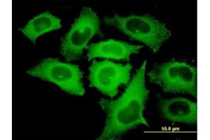 Immunofluorescence of monoclonal antibody to TIPIN on HeLa cell. (TIPIN anticorps  (AA 1-301))