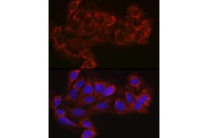 Immunofluorescence analysis of U-2 OS cells using EIF4E2 Rabbit pAb (ABIN6130366, ABIN6140086, ABIN6140087 and ABIN6220578) at dilution of 1:100 (40x lens). (EIF4E2 anticorps  (AA 1-240))