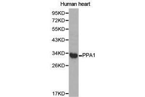 Western Blotting (WB) image for anti-Pyrophosphatase (Inorganic) 1 (PPA1) antibody (ABIN1874203) (Pyrophosphatase (Inorganic) 1 (PPA1) anticorps)