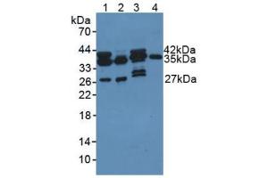 Figure. (PDXK anticorps  (AA 35-251))