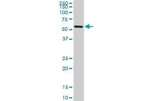 Western Blotting (WB) image for anti-Oxidative-Stress Responsive 1 (OXSR1) (AA 1-528) antibody (ABIN599106) (OXSR1 anticorps  (AA 1-528))