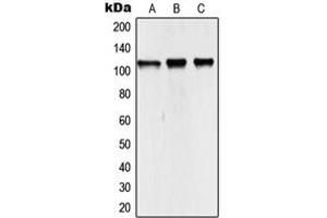 Western blot analysis of NCOA7 expression in HEK293T (A), mouse kidney (B), rat kidney (C) whole cell lysates. (NCOA7 anticorps  (Center))