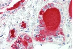 Human Thyroid: Formalin-Fixed, Paraffin-Embedded (FFPE)