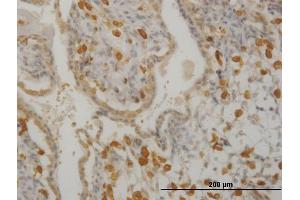 Immunoperoxidase of monoclonal antibody to HCLS1 on formalin-fixed paraffin-embedded human placenta. (HCLS1 anticorps  (AA 266-355))