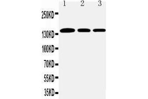 Anti-Collagen I antibody, Western blotting Lane 1: Rat Lung Tissue Lysate Lane 2: Human Placenta Tissue Lysate Lane 3: Rat Testis Tissue Lysate