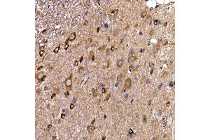 Immunohistochemistry of paraffin-embedded mouse spinal cord using DYNC1LI2 Rabbit pAb (ABIN7266863) at dilution of 1:25 (40x lens).