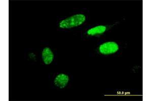 Immunofluorescence of monoclonal antibody to HIC1 on HeLa cell. (HIC1 anticorps  (AA 396-453))