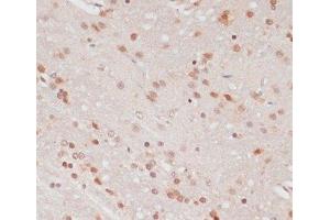 Immunohistochemistry of paraffin-embedded Rat brain using Phospho-PEA15(S104) Polyclonal Antibody at dilution of 1:100 (40x lens).