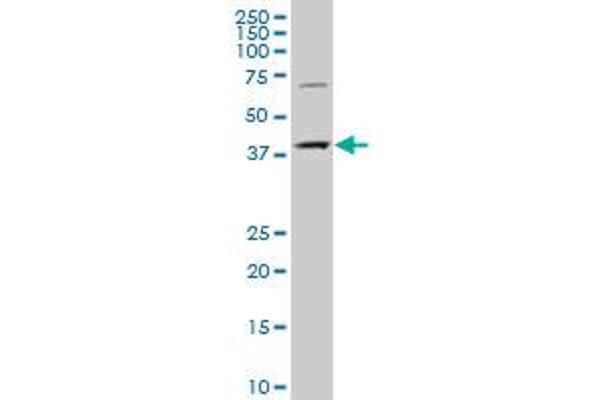 CMPK2 antibody  (AA 151-250)