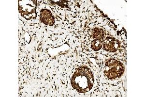 IHC analysis of CLPB using anti-CLPB antibody (ABIN7601732). (CLPB anticorps  (AA 438-707))