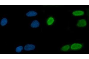 IF analysis of TRMT10C using anti-TRMT10C antibody (ABIN7601472).