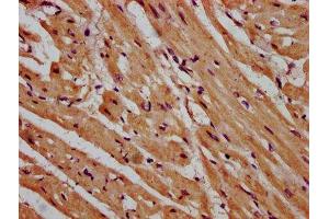 IHC image of ABIN7158901 diluted at 1:600 and staining in paraffin-embedded human heart tissue performed on a Leica BondTM system. (MPP3 anticorps  (AA 301-432))