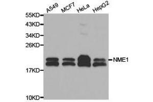 Western Blotting (WB) image for anti-Non-Metastatic Cells 1, Protein (NM23A) Expressed in (NME1) (C-Term) antibody (ABIN1873911) (NME1 anticorps  (C-Term))